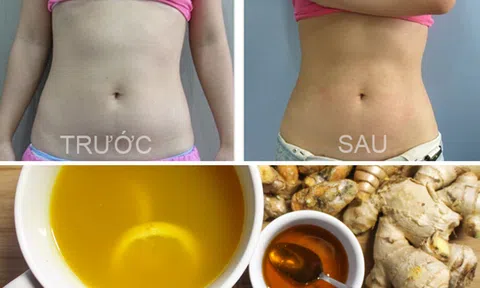 Hướng dẫn cách giảm mỡ bụng bằng gừng và mật ong hiệu quả